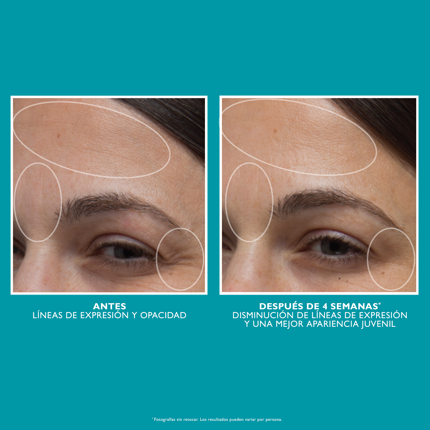 PEPTIDE SKINJECTION™ MOISTURE INFUSION REFILLABLE CREAM (CREMA HIDRATANTE)